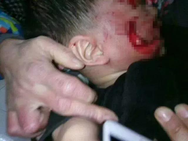 小孩被狗咬事件，警示与反思的最新视频曝光